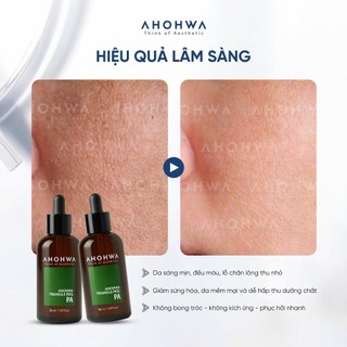 Ahohwa - Triangle Peel PA - PEEL DA ĐA TẦNG, TÁI TẠO BỀ MẶT DA ÊM DỊU  - 50ml