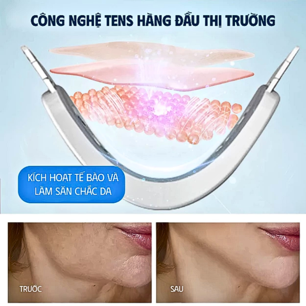 Máy Massage Nâng Cơ Mặt Tạo Cằm V-Line Thông Minh - Đai Massage EMS 12 Cấp Độ, Nâng Cơ Trẻ Hóa Da