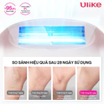 [Hannah LIVE]Máy triệt lông Ulike Swift 7 công nghệ làm mát Ice Cooling IPL Sapphire Hồng — ảnh 6
