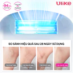 [Hannah Live] Máy triệt lông Ulike ME công nghệ làm mát Ice Cooling IPL Sapphire Xanh thiên thanh — ảnh 3