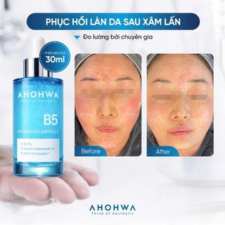 Ahohwa - Tinh chất cấp ẩm và phục hồi da Hydration ampoule B5 _ 30ml