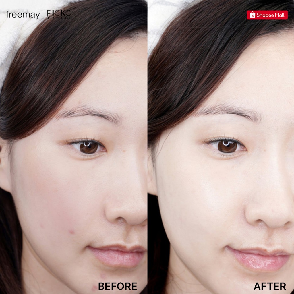 (Date 10/2027) Combo 2 Toner Freemay Thuần Chay Heartleaf Calm Down Moisture - Dưỡng Ẩm Da, Làm Diu Da  (350ml x 2 chai)