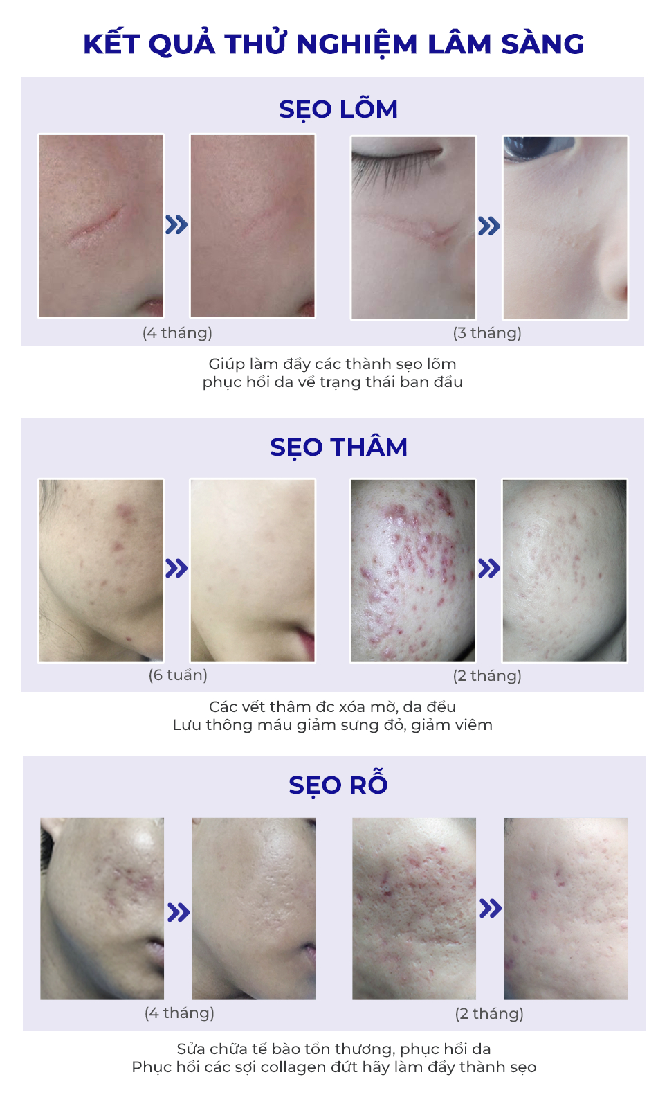 Thông tin sản phẩm Scar Esthetique