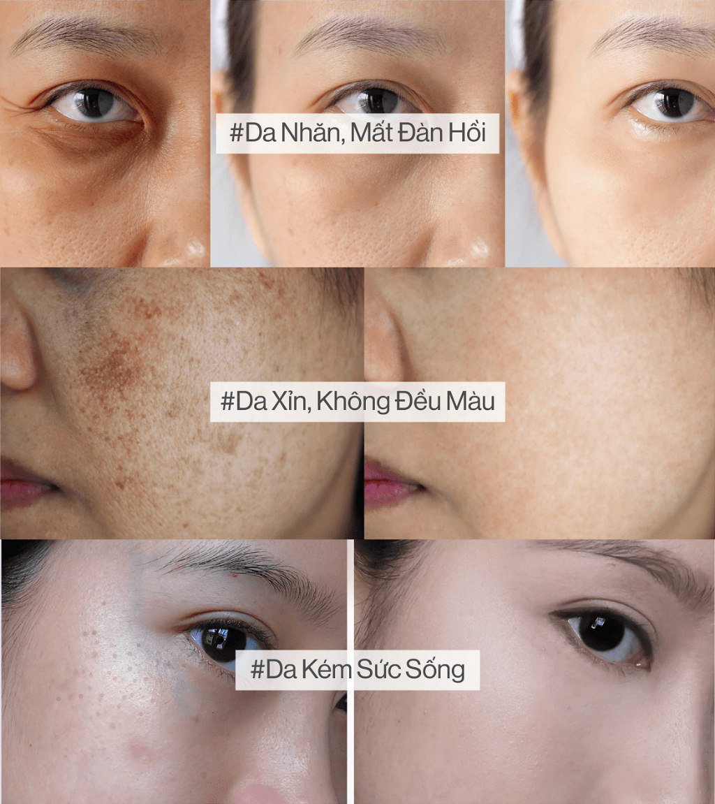 Mô tả Combo 2 chai 50ml: mờ thâm nám sạm, tàn nhang, đốm nâu, đồi mồi, chân chim, sáng da với serum collagen KIHASU nam + nữ - 1