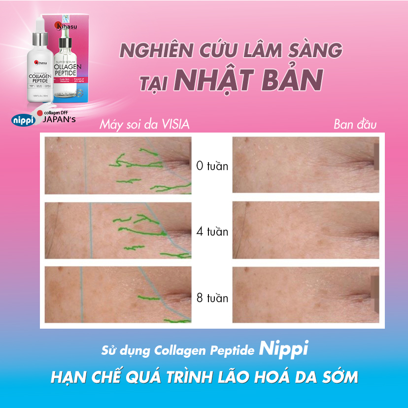 Mô tả Serum Sáng da với serum collagen tươi KIHASU cao cấp từ Nhật Bản: chuyên sâu về da, chống lão hoá da, tăng đàn hồi da - 1
