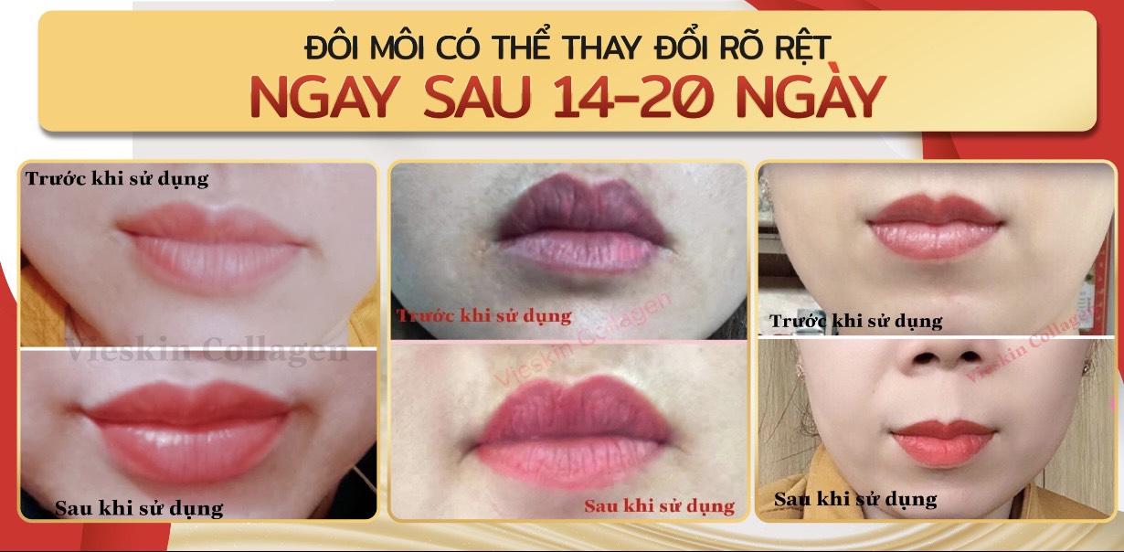 Mô tả Tinh chất collagen tươi Vieskin Luxury dưỡng môi sau phun xăm, kích màu sắc nét, tự nhiên, siêu căng bóng, lọ 7ml - 7