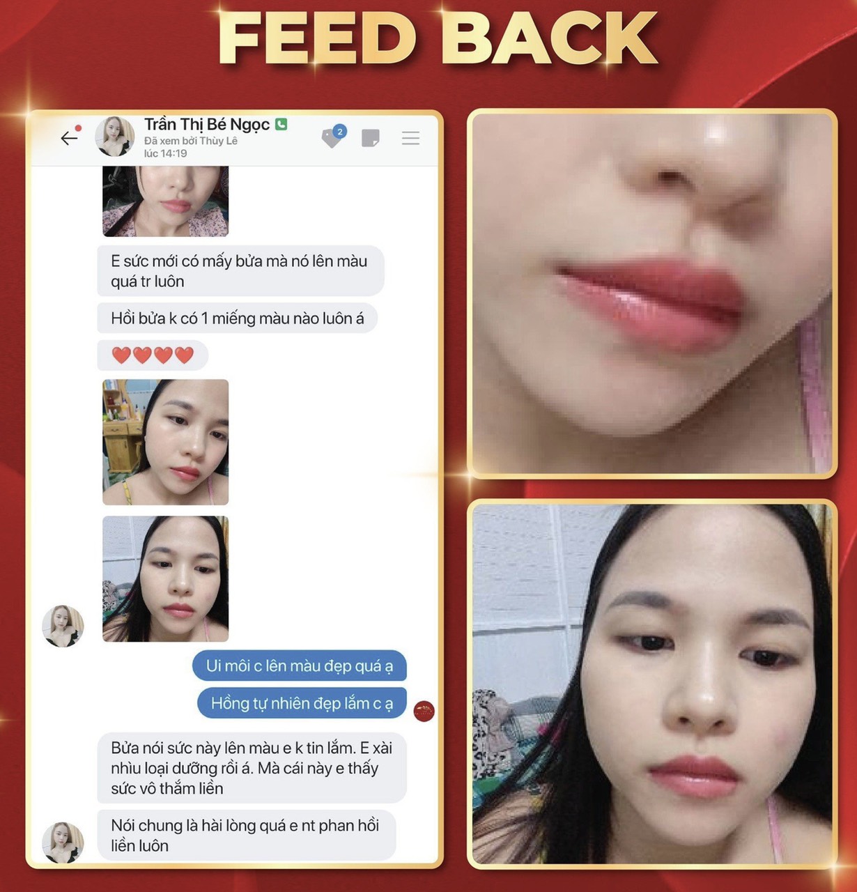 Vieskin GoldShine cho môi đẹp sau xăm