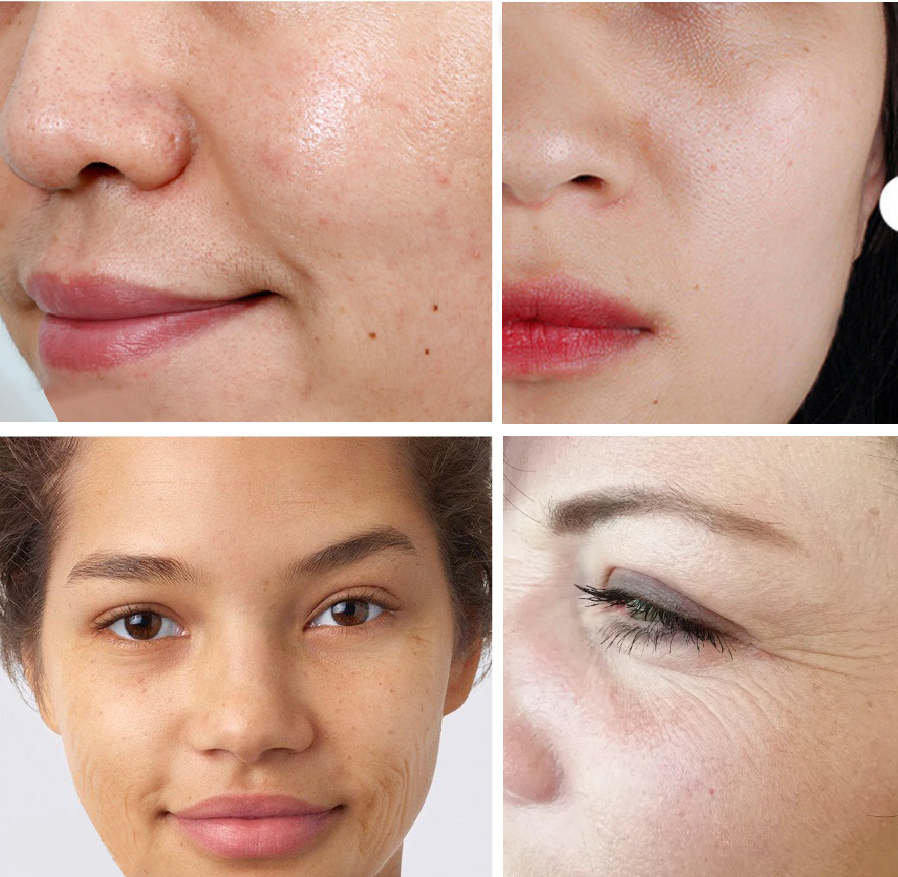 Mô tả Combo bột Kihasu collagen peptide: giúp sáng da, trắng da bạn, mờ nám sạm đốm nâu trên da - 1
