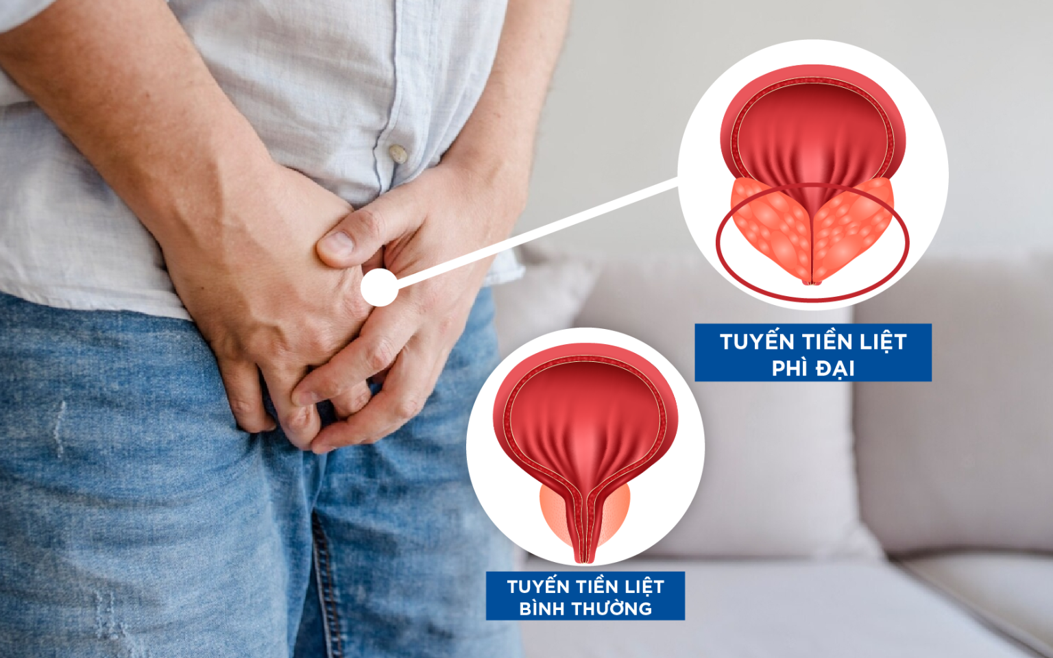 Mô tả Viên Uống Hỗ Trợ U Xơ Tuyến Tiền Liệt, Tiểu Khó, Tiều Đêm, Tiểu Nhiều Lần ở nam giới - Zlove - 1