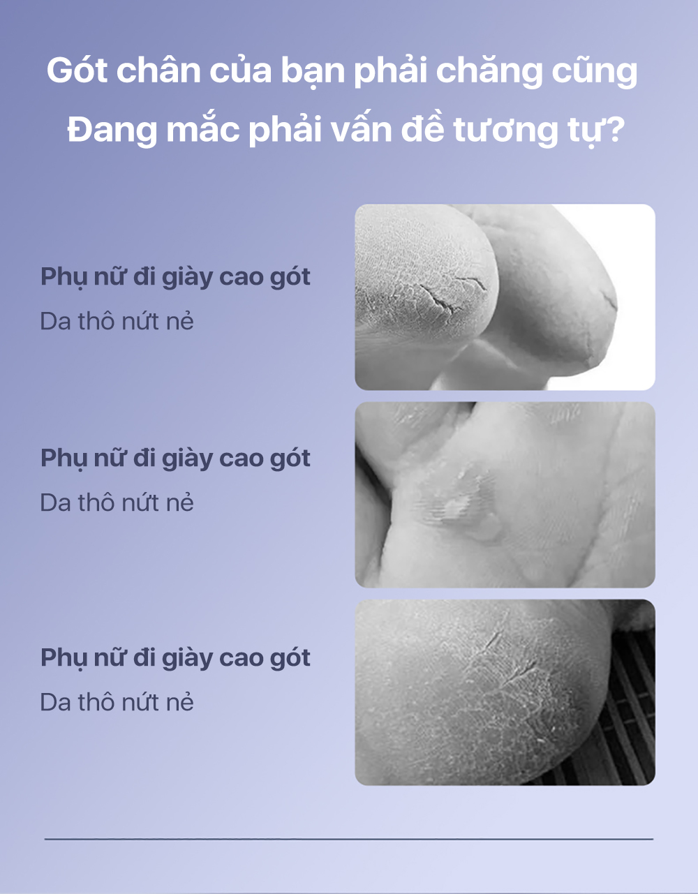 Mô tả Máy tẩy vết chai chân Enchen Rock chà và làm mịn chăm sóc gót chân - 3