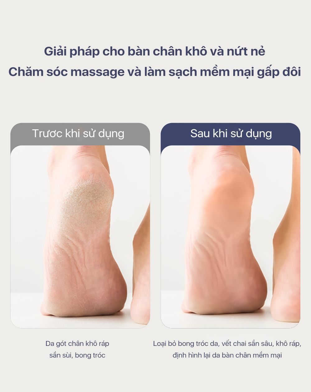 Mô tả Máy tẩy vết chai chân Enchen Rock chà và làm mịn chăm sóc gót chân - 10
