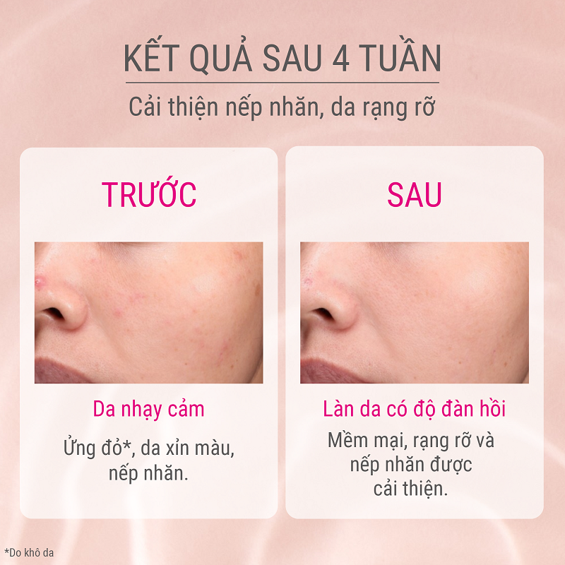 Mô tả Dưỡng chất ngăn lão hóa sớm Intense Enriching Serum 45ml - 5