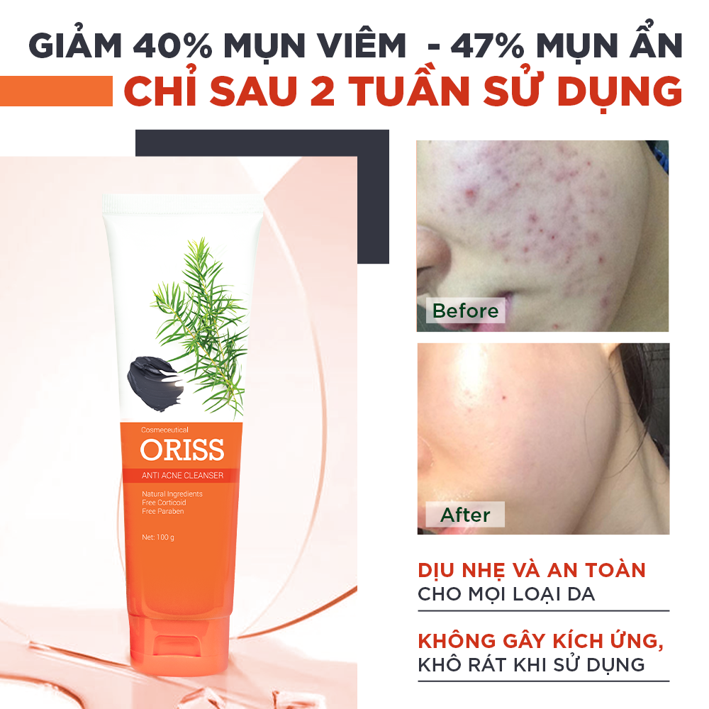 Mô tả Sữa rửa mặt ngừa mụn Oriss dưỡng ẩm tẩy tế bào chết thu nhỏ lỗ chân lông 100g - 2