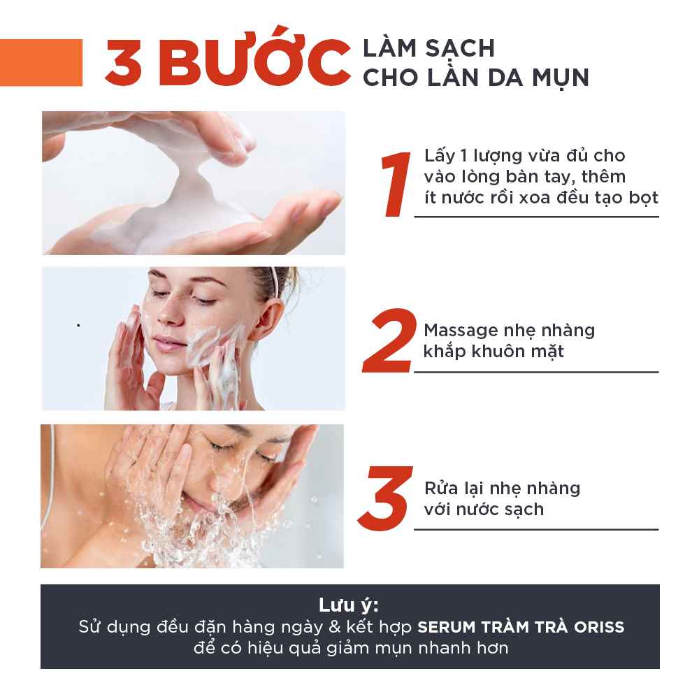 Mô tả Sữa rửa mặt ngừa mụn Oriss dưỡng ẩm tẩy tế bào chết thu nhỏ lỗ chân lông 100g - 6