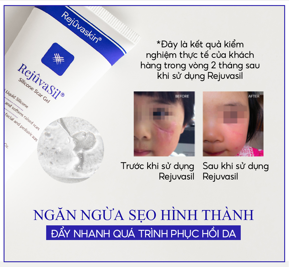 Mô tả Sample Gel ngăn ngừa sẹo và làm xẹp sẹo lồi, sẹo phì đại REJUVASKIN Rejuvasil 1ml - 5