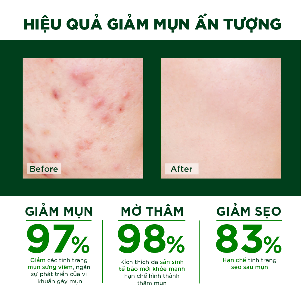 Mô tả Kem chấm mụn Oribe giảm mụn ẩn mờ thâm liền sẹo 20g - 1