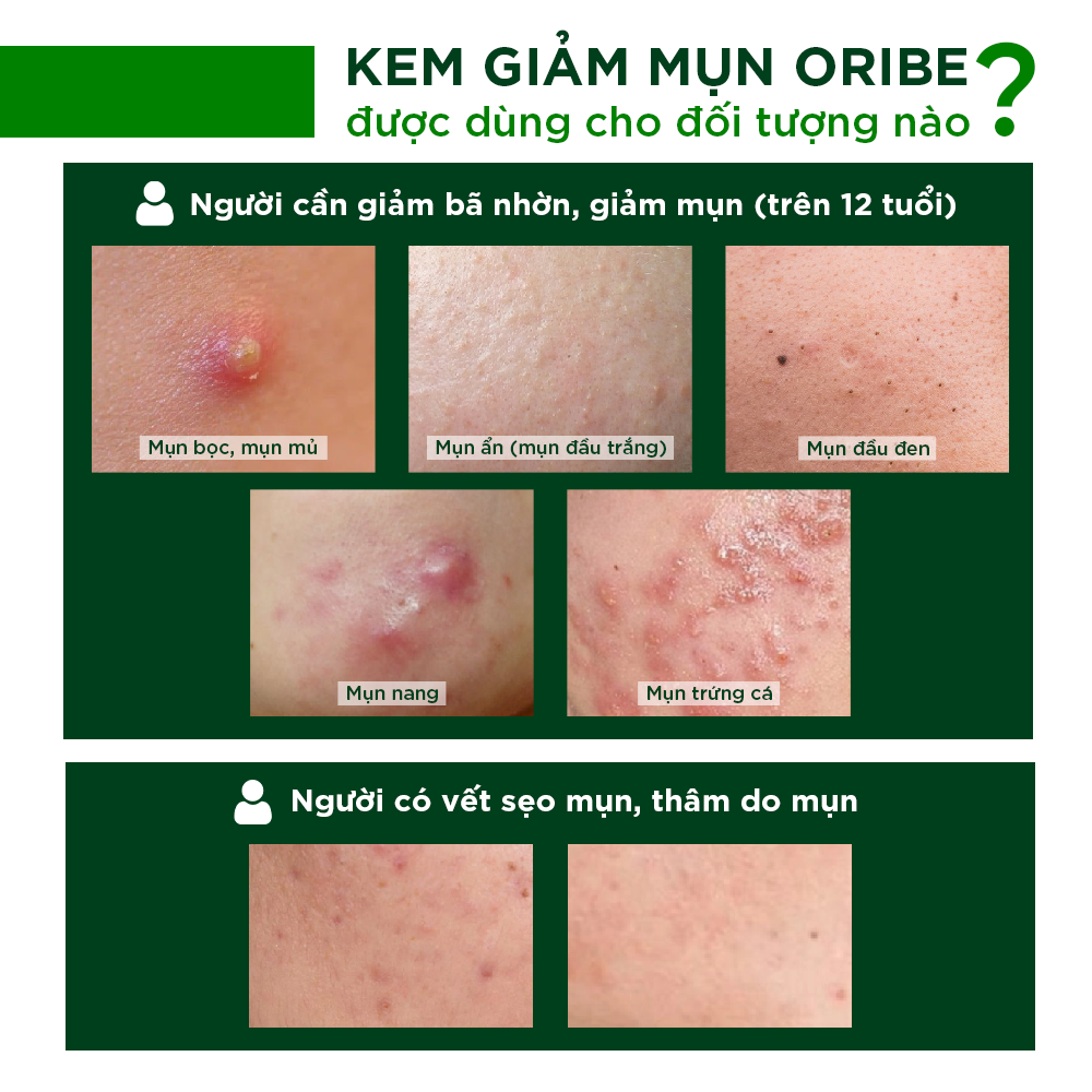 Mô tả Kem chấm mụn Oribe giảm mụn ẩn mờ thâm liền sẹo 20g - 3