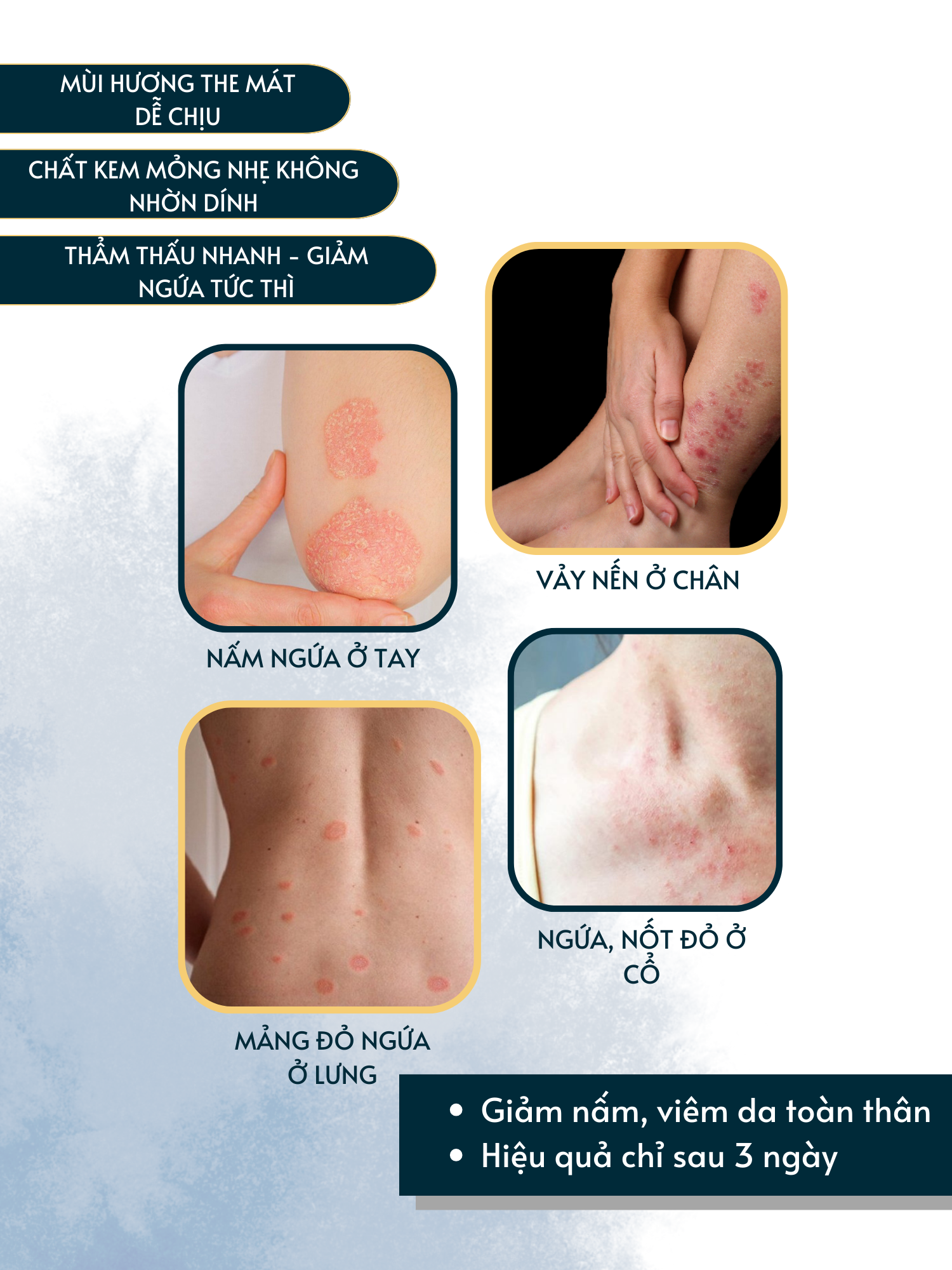Mô tả Kem bôi nấm da hắc lào mề đay vảy nến á sừng eczema Dego Pharma 30g - 3