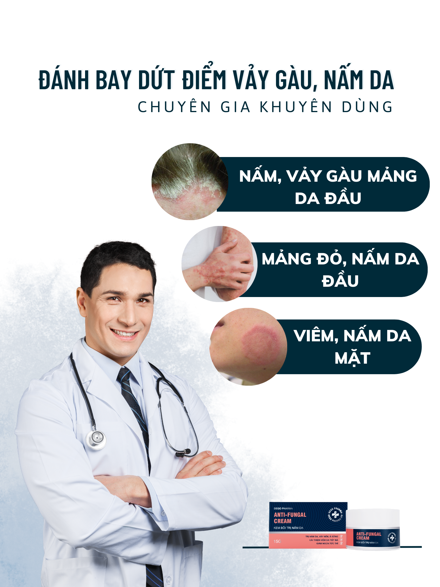 Mô tả Kem bôi nấm da hắc lào mề đay vảy nến á sừng eczema Dego Pharma 30g - 4