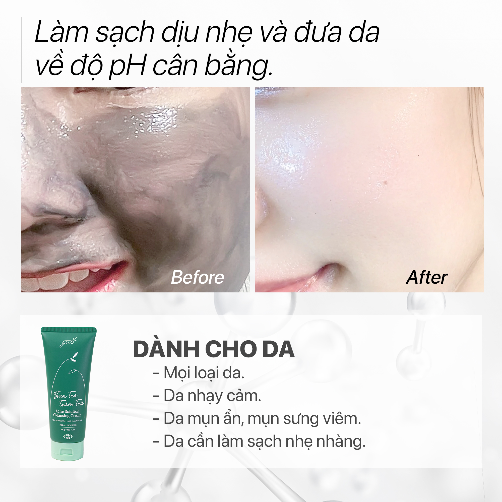 Mô tả Sữa Rửa Mặt Than Tre Tràm Trà sạch mụn kiềm dầu không SLS, dịu nhẹ cho nhạy cảm pH 5.5 GUO - 2