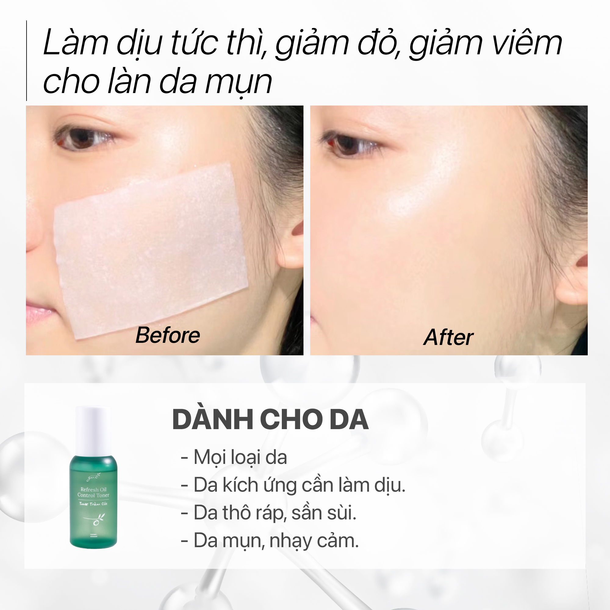 Mô tả Toner tràm cúc kiềm dầu, cấp ẩm, ngừa mụn, cân bằng, dịu nhẹ cho da nhạy cảm GUO 100ml - 2