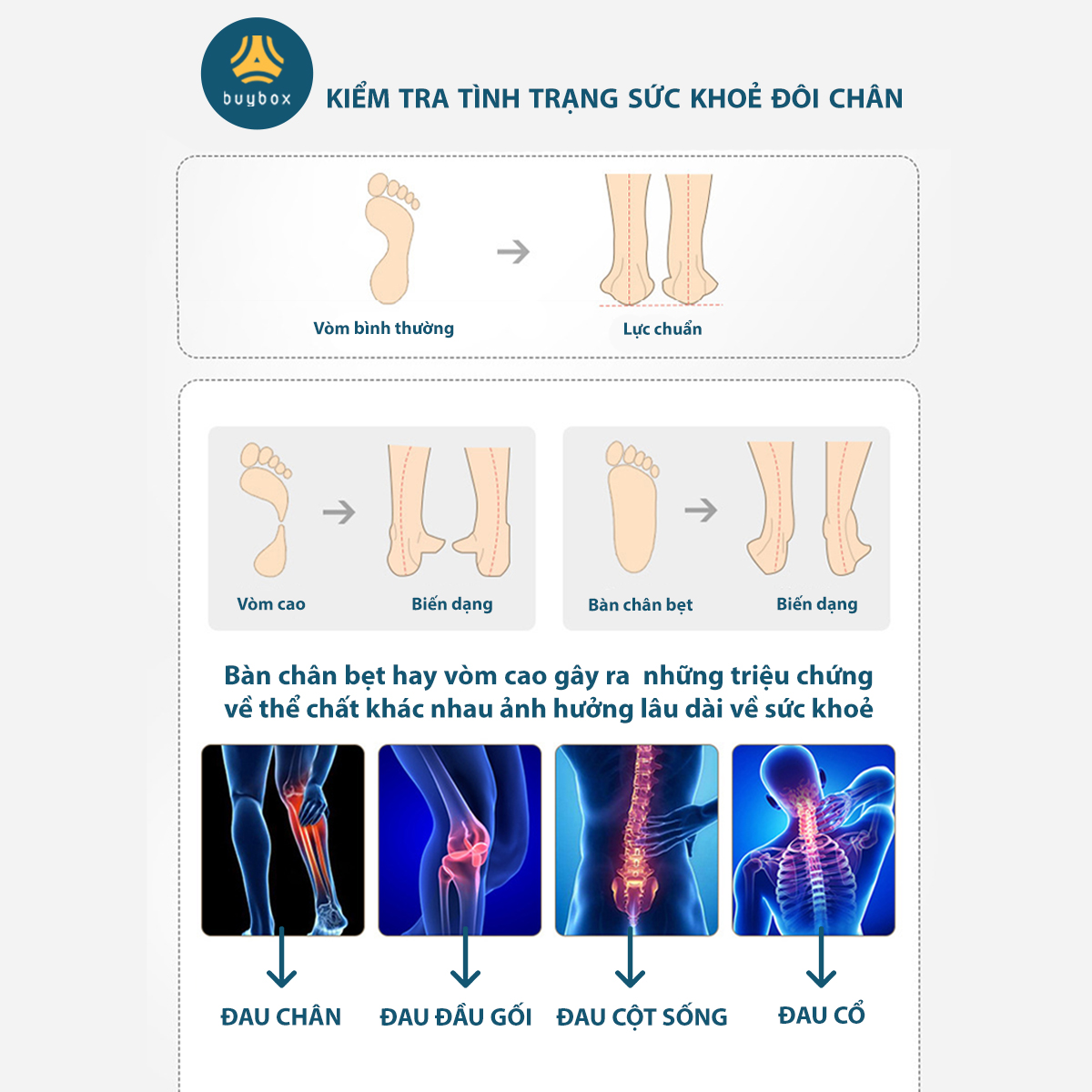 Mô tả Lót giày thể thao 4D có gờ chống sốc giảm mỏi gang bàn chân - buybox - BBPK36 - 10