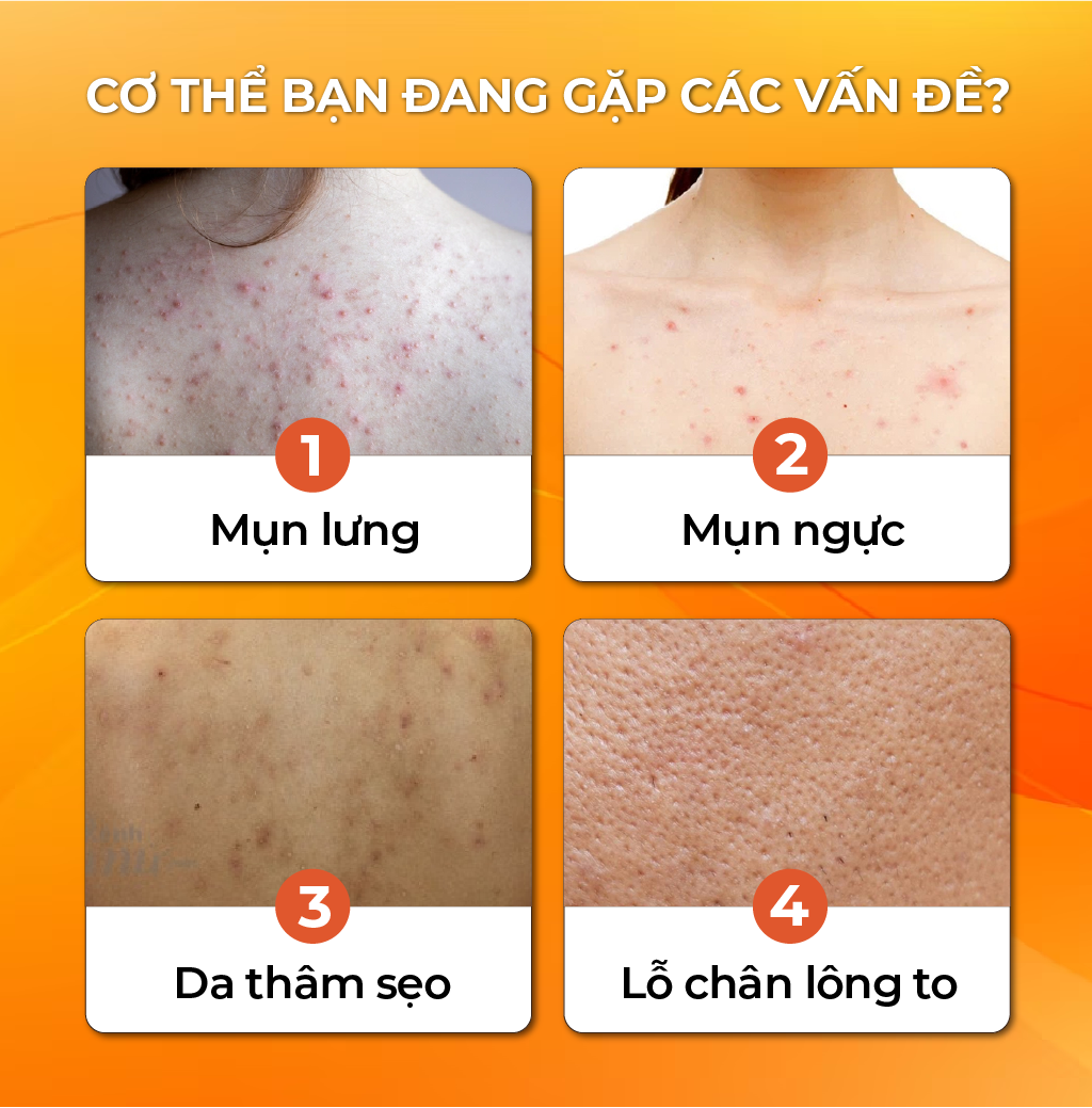 Mô tả Sữa Tắm Thảo Dược Gừng Nghệ Cỏ Cây Hoa Lá 30g Làm Sạch Sâu, Ngăn Ngừa Mụn Trên Da - 2