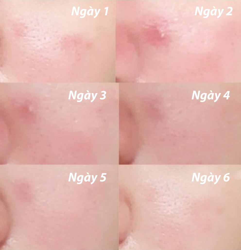 Mô tả Tinh Chất Rau Má Cấp Ẩm Làm Dịu Da Ample:N Centel Calming Shot Ampoule - 7