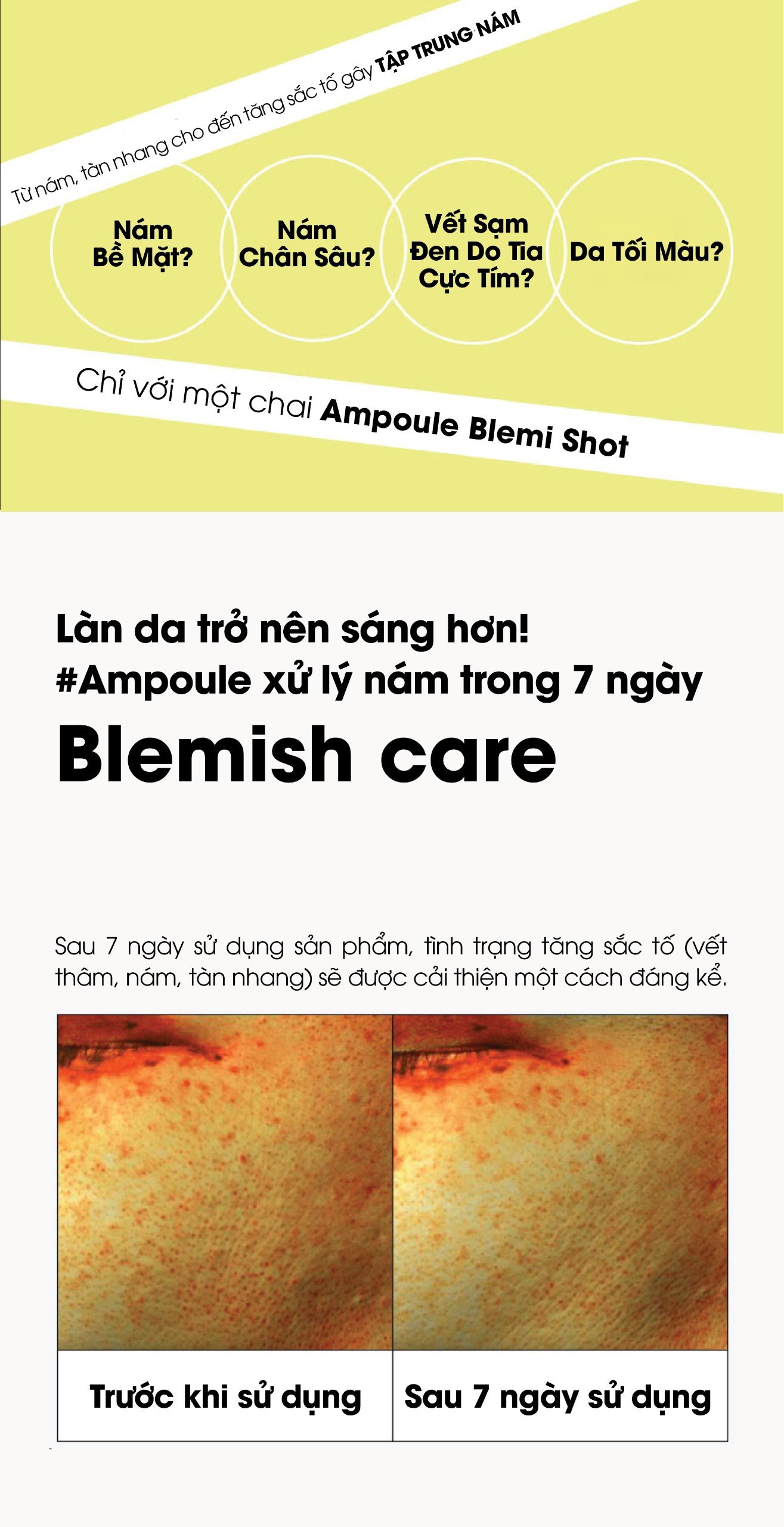 Mô tả Tinh Chất Dưỡng Sáng Da AMPLE:N Blemi Shot Ampoule - 6
