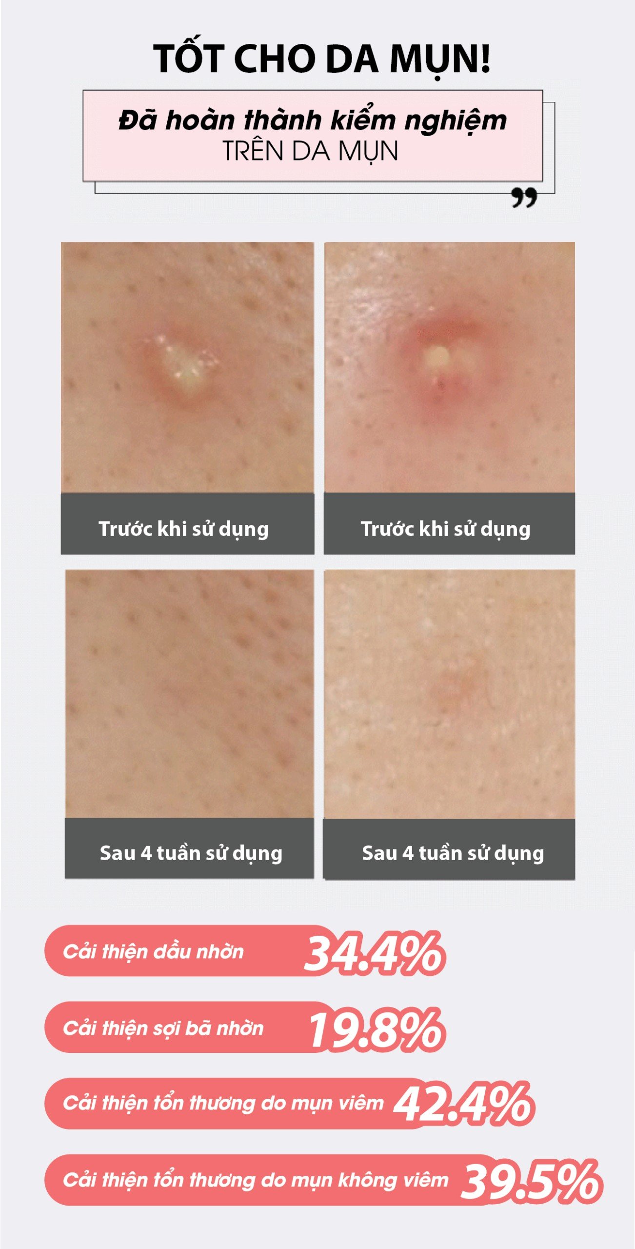 Mô tả Bông Toner Cho Da Mụn AMPLE:N Acne Shot Toner Pad 60 Miếng - 8