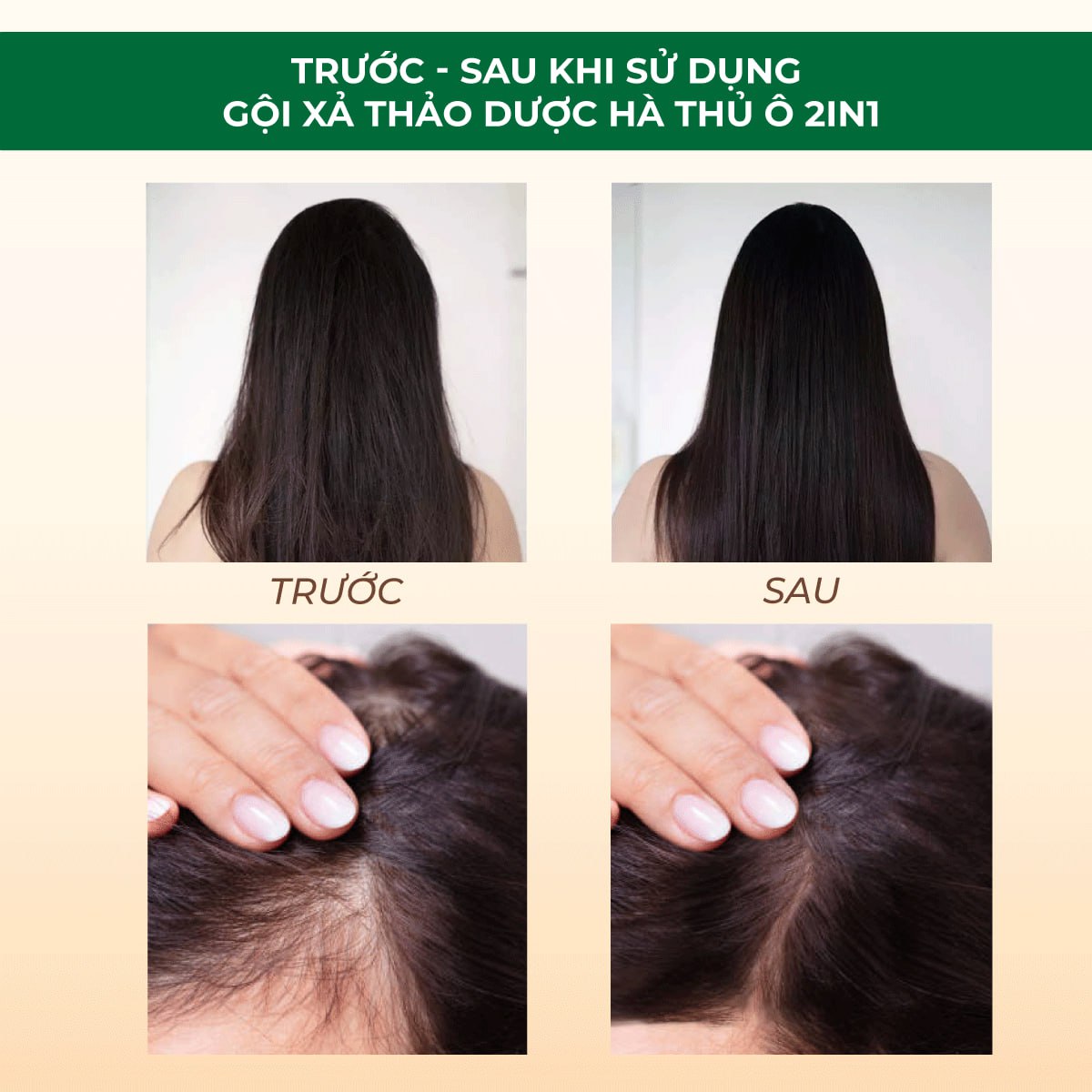 Mô tả Dầu Gội Thảo Dược Hà Thủ Ô 2in1 Cỏ Cây Hoa Lá 420g - Giảm Gãy Rụng, Dưỡng Tóc Chắc Khỏe - 6