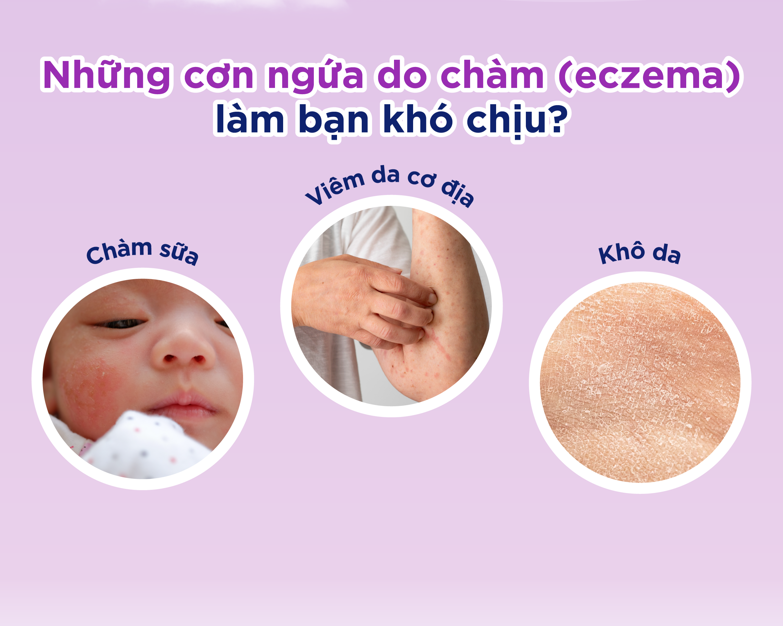 Mô tả Combo 3 Kem Giảm Ngứa BEPANTHEN Itch Relief Cream 20G x3 Giảm Ngứa Nhanh Trong 30 Phút - 3