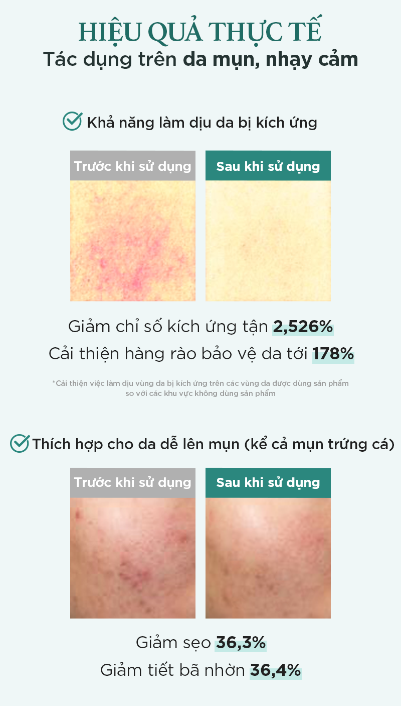 Mô tả Kem dưỡng ẩm làm dịu & phục hồi da I'm from Licorice Calming Cream 50ml [Vỏ bẩn nhẹ] - 9