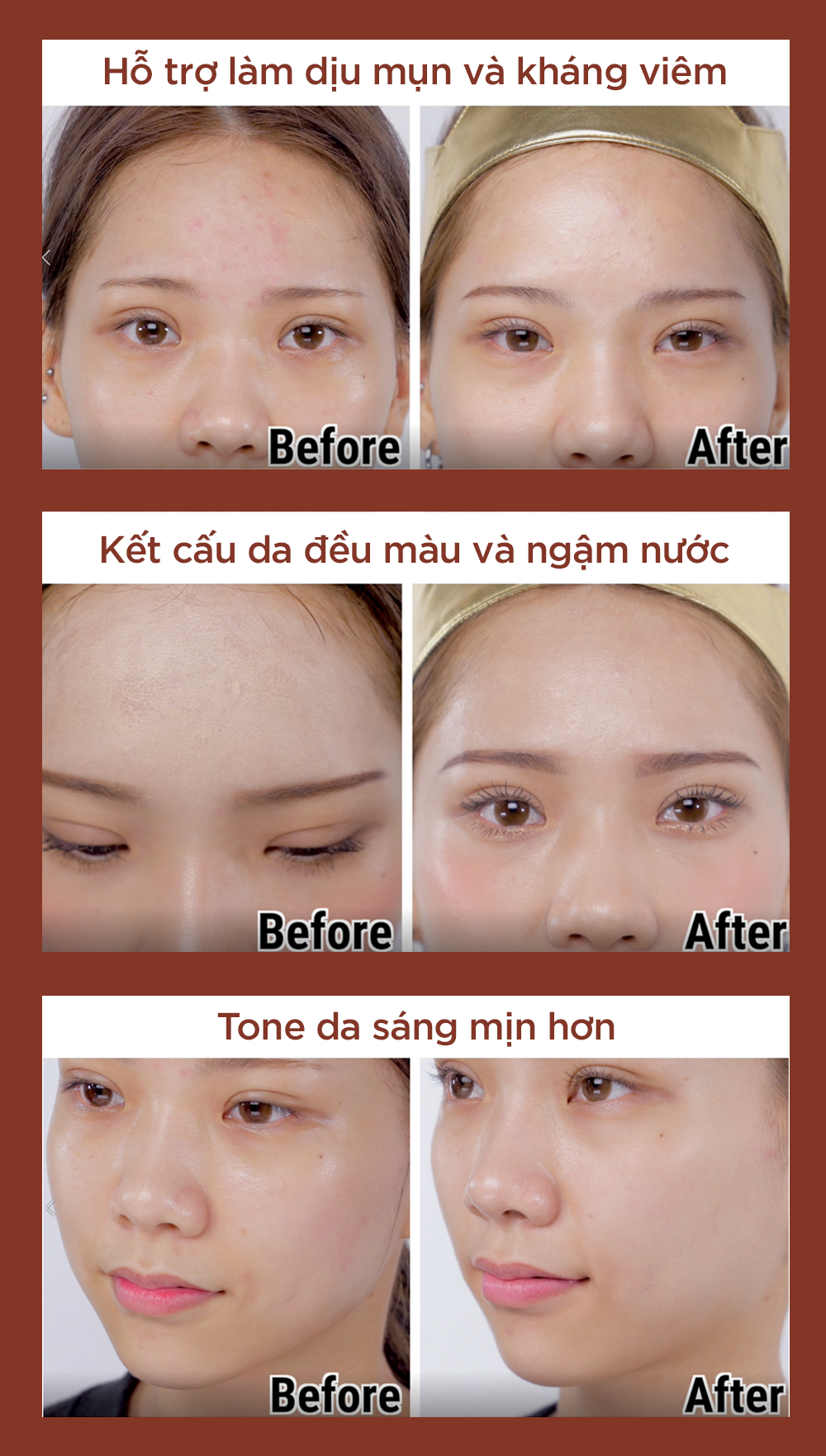 Mô tả 1 toner Mandelic 30ml + 2 sachet bakuchiol 1g HOẶC kem chống nắng 1.5g - 7