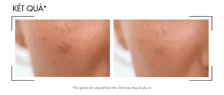 Vichy Liftactiv B3 review