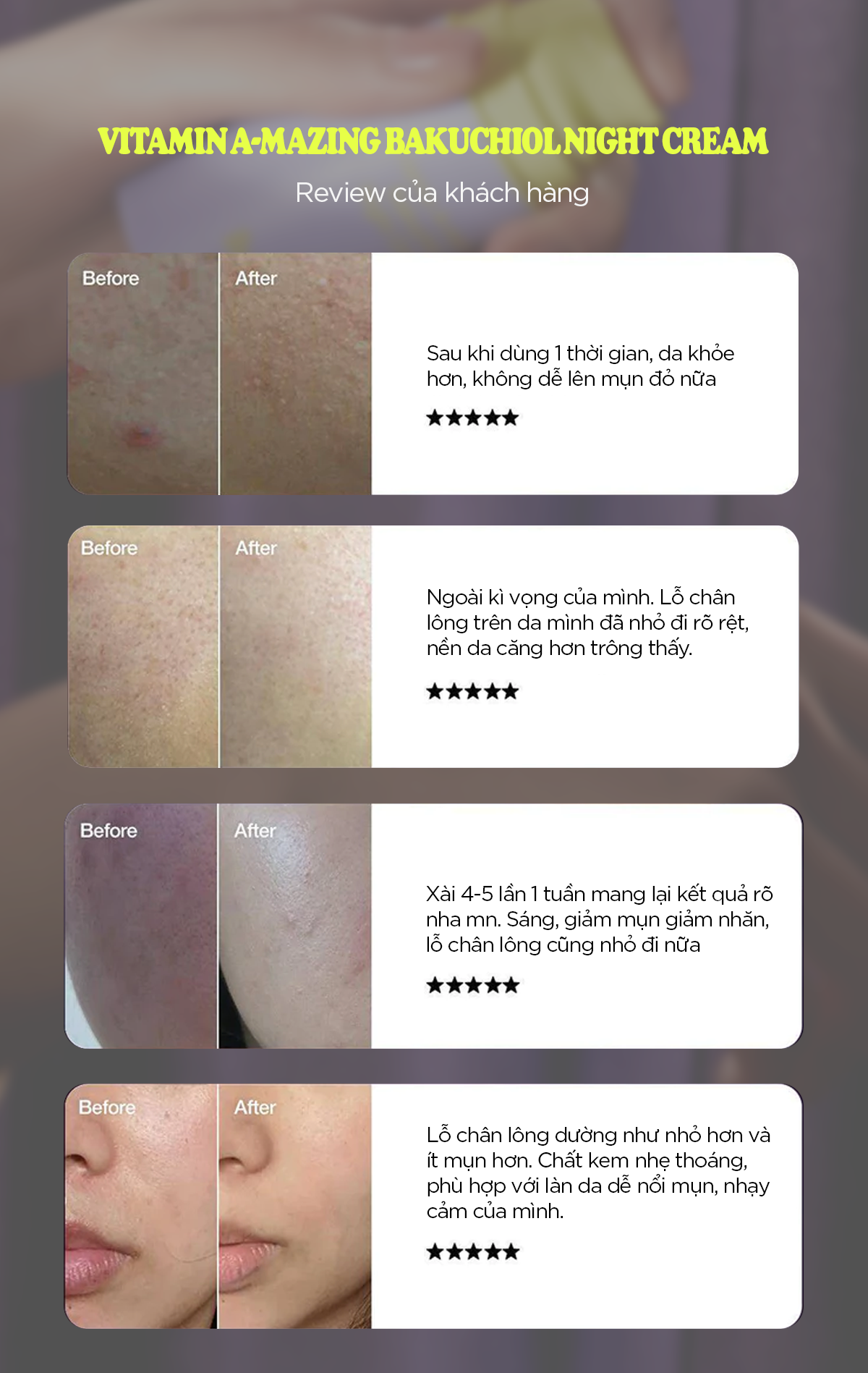 Mô tả 1 kem dưỡng vitamin A-mazing Bakuchiol Night Cream 10g+ 1 toner mandelic 30ml + 1 mask  Natural Vitamin 2 - 9