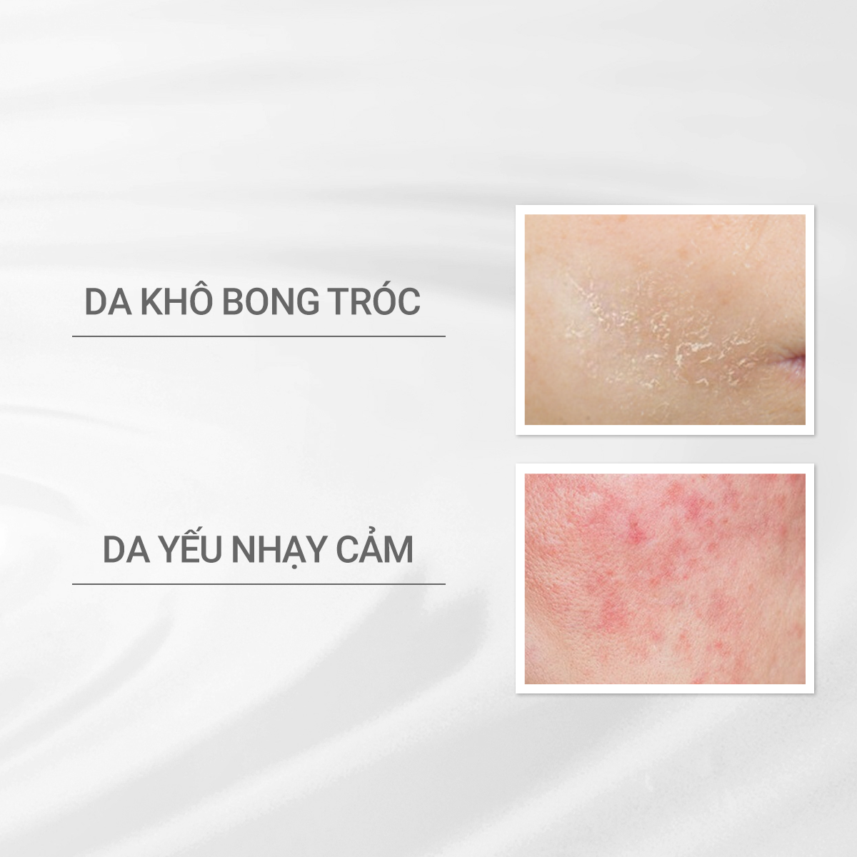 Mô tả Nước cân bằng cho da khô nhạy cảm Dprogram Microbiome Moist Care Lotion 125ml - 2