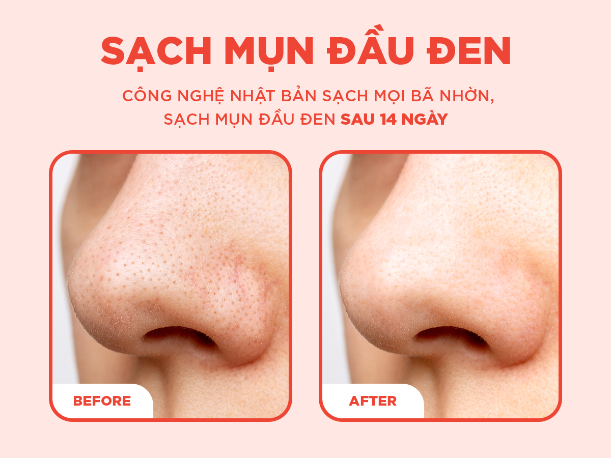 Mô tả Bộ đôi Sáp tẩy trang 100g và Sữa rửa mặt 100g LANCI làm sạch chuyên sâu cho làn da - 3