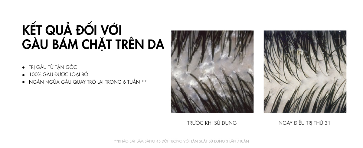 Thành phần và công dụng Vichy Dercos