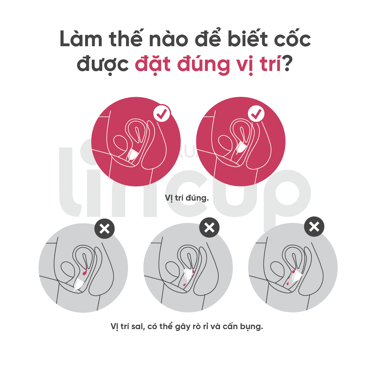 Mô tả Combo Cốc nguyệt san Lincup đi kèm túi lụa, bàn chải vệ sinh cốc - 2