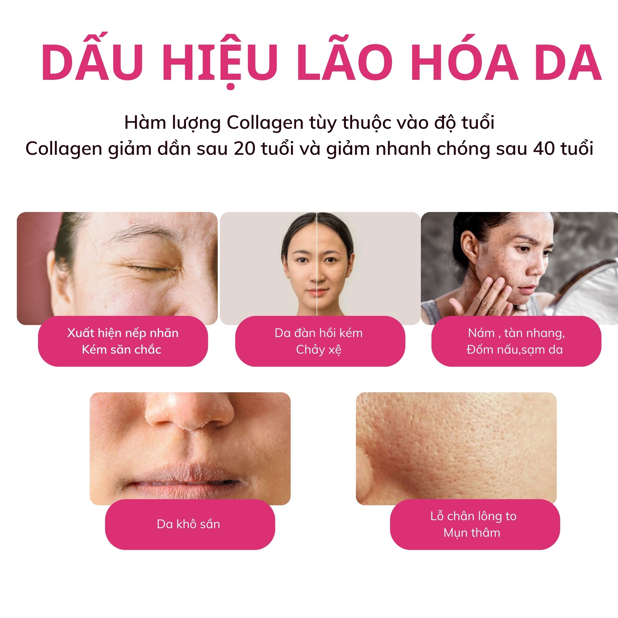 Mô tả Bột Collagen BBLAB Mẫu Mới Low Molecular Collagen S Chậm Lão Hóa Da, Sáng Da Căng Bóng, Giảm Nếp Nhăn, Mờ Nám 30 Gói/Hộp - 6