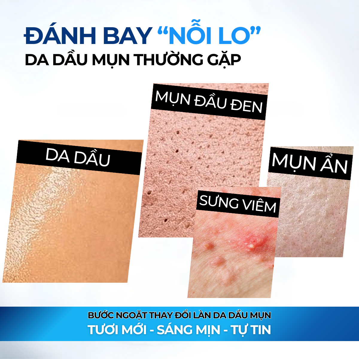 Mô tả Bộ Chăm Sóc Da Mặt Kem Giảm Thâm Chấm Mụn Compliment Smoothe 25ml & Sữa Rửa Mặt Da Dầu Mụn 200ml - 7