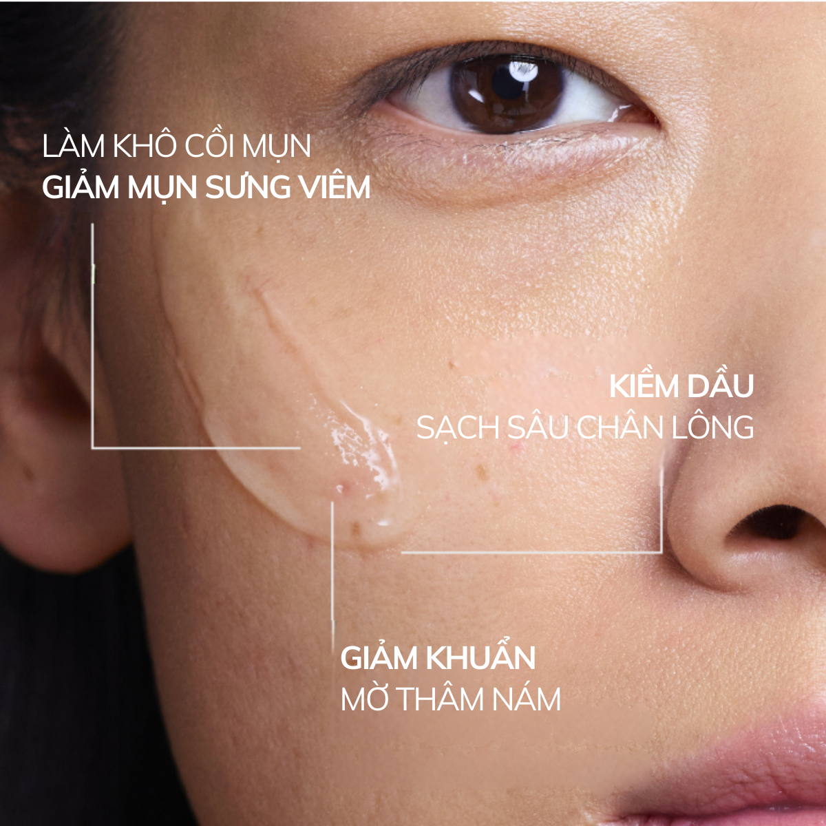 Mô tả Gel Chấm Mụn Compliment - Sạch Mụn, Giảm Thâm, Kiềm Dầu 25ml - 6