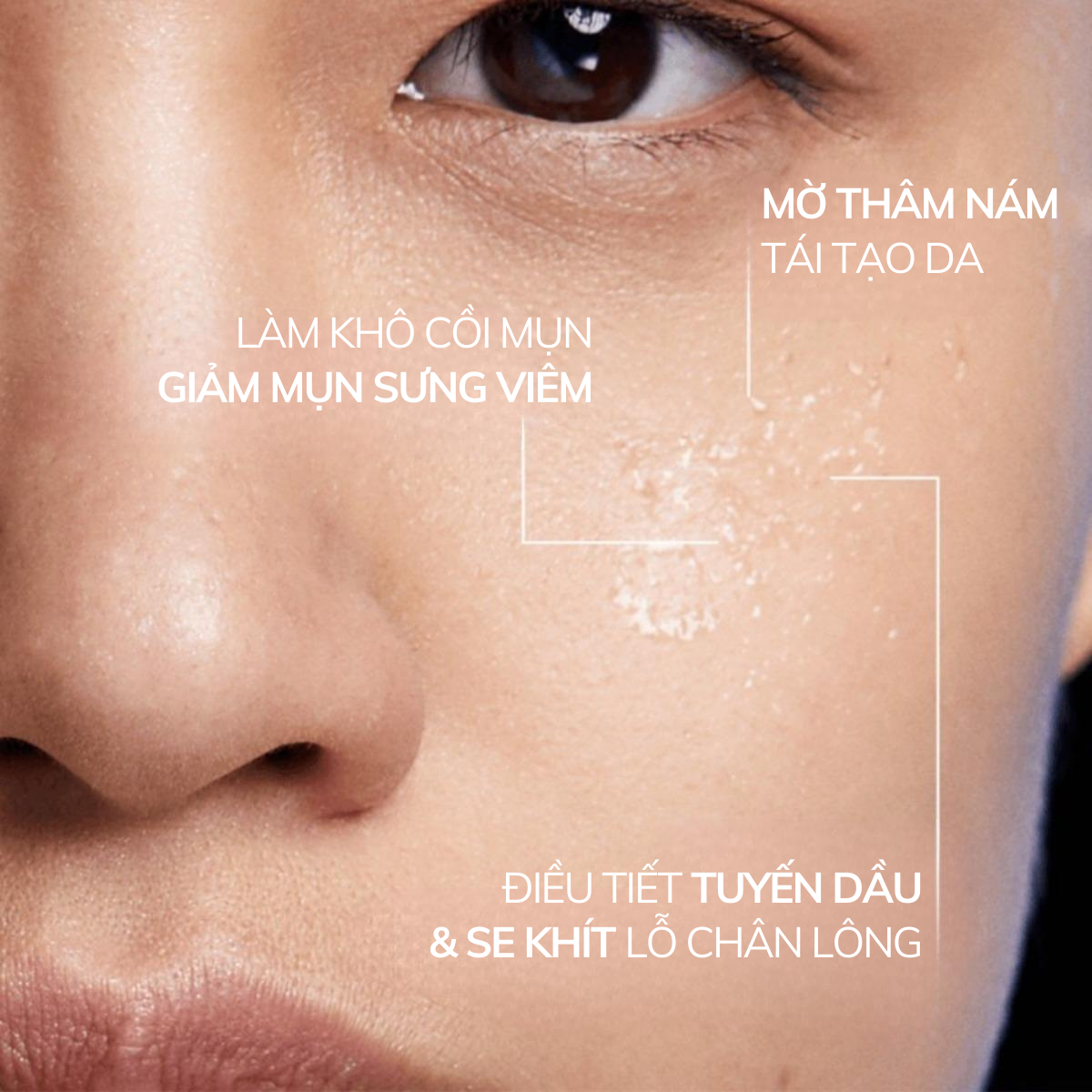 Mô tả Bộ Chăm Sóc Da Dầu Mụn AHA BHA PHA Compliment, Sữa Rửa Mặt, Kem Dưỡng Ẩm, Serum, Kem Chấm Mụn - 4