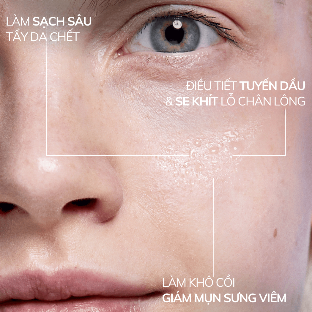 Mô tả Bộ Chăm Sóc Da Giảm Sưng Viêm Mụn, Tẩy Da Chết BHA Salicylic Compliment - 4