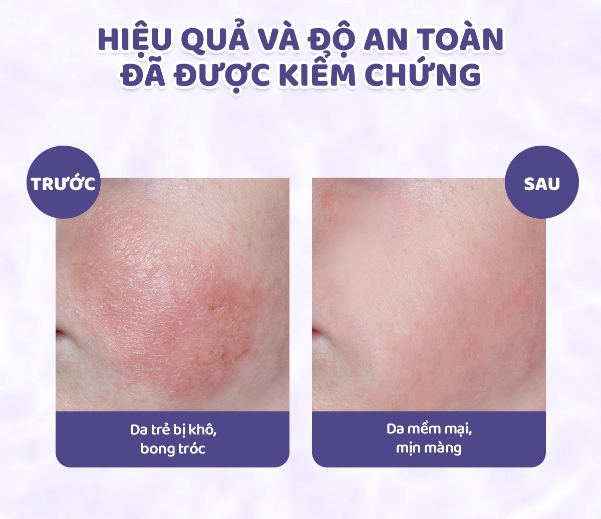 Mô tả Gel Tắm Gội Hữu Cơ JONZAC Dành Cho Bé Từ Sơ Sinh (250Ml-500Ml) - 8