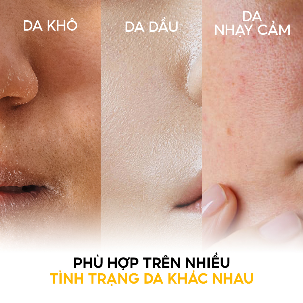 Giá kem chống nắng Tenamyd