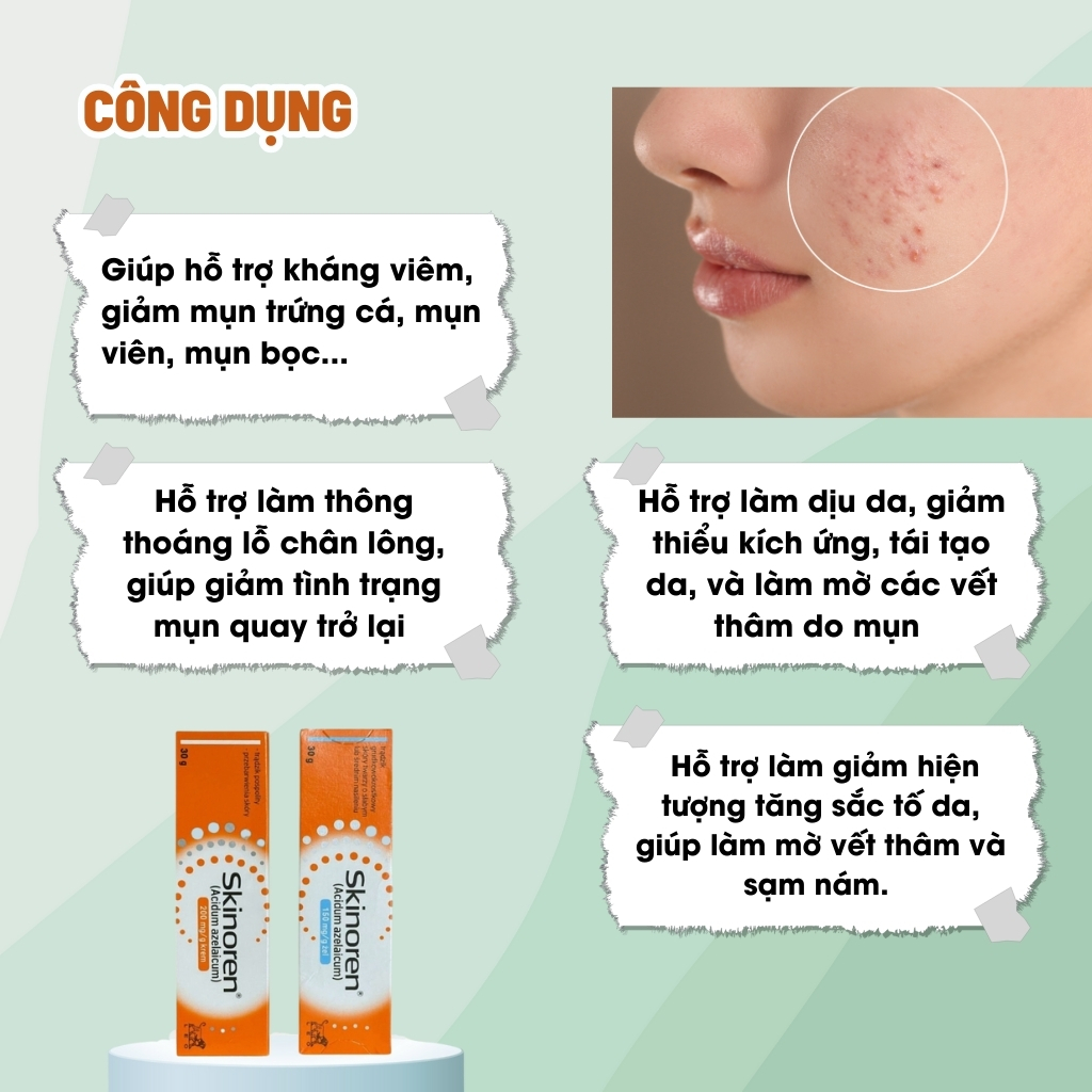 Kem bôi mụn skinoren 20% Acid azelaic 30g Ba Lan giảm sự hình thành mụn ...