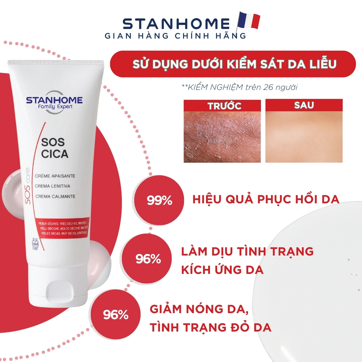 Công dụng Kem dưỡng ẩm phục hồi da Stanhome Sos Cica