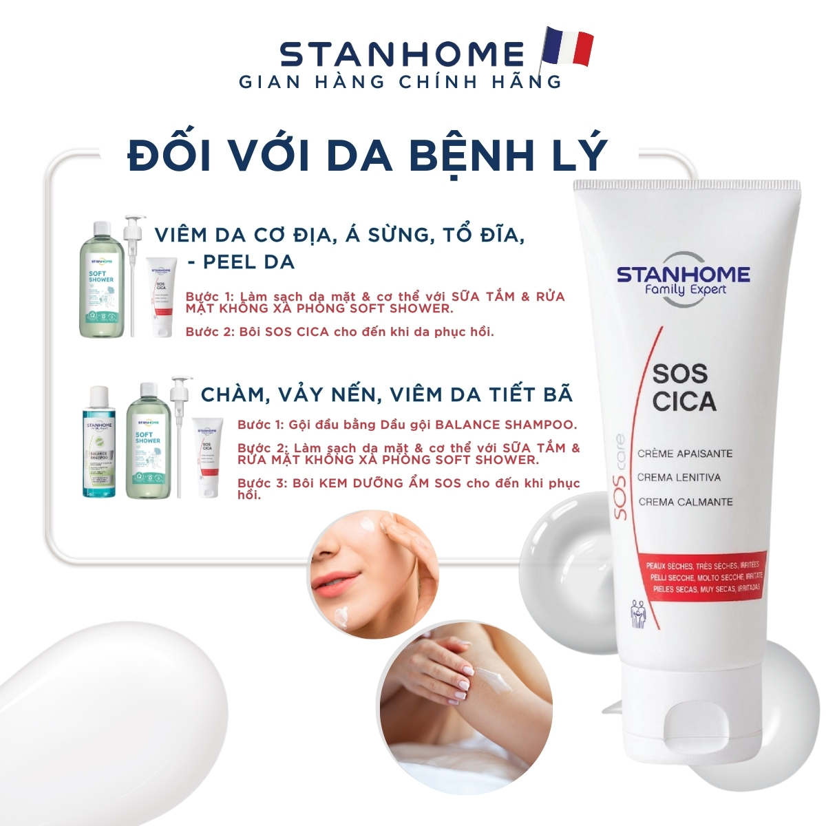 Đối tượng sử dụng Kem Stanhome Sos Cica